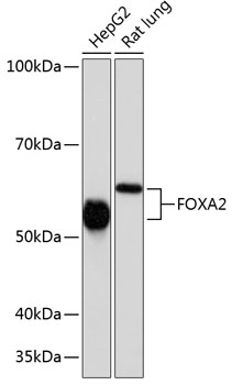 Anti-FOXA2 Antibody (CAB19053)