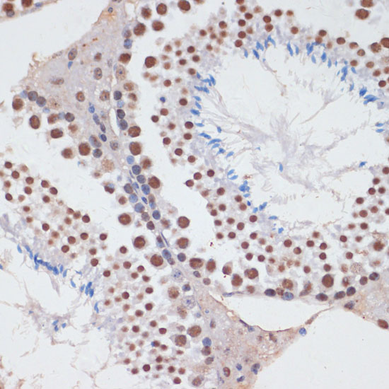 Anti-PCNA Antibody (CAB0264)