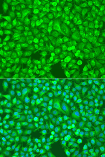 NF-kB2 Rabbit Polyclonal Antibody (CAB11163)