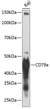 Anti-CD79a Antibody (CAB19024)