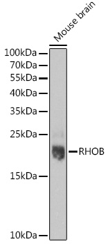 Anti-RHOB Antibody (CAB16762)