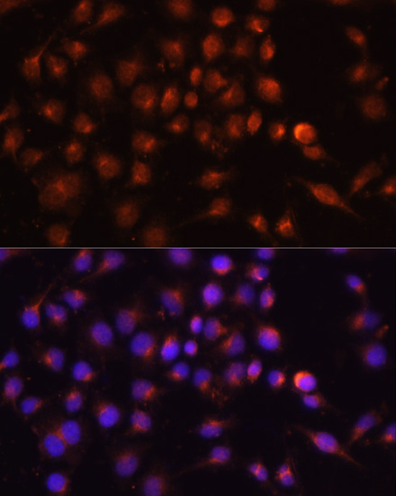 Anti-RAB11A Antibody (CAB17031)