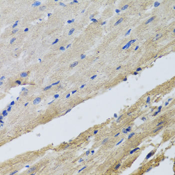 Anti-FECH Polyclonal Antibody (CAB8418)