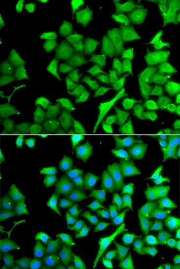 Anti-NAA50 Antibody (CAB7387)