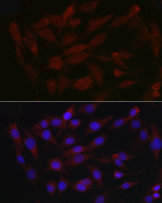 Anti-cIAP2 Antibody (CAB0833)