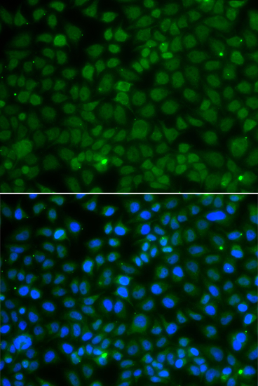 Anti-WDR45 Antibody (CAB7581)