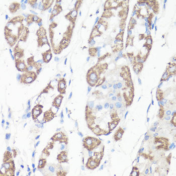 Anti-VDAC1 / Porin Antibody (CAB15735)