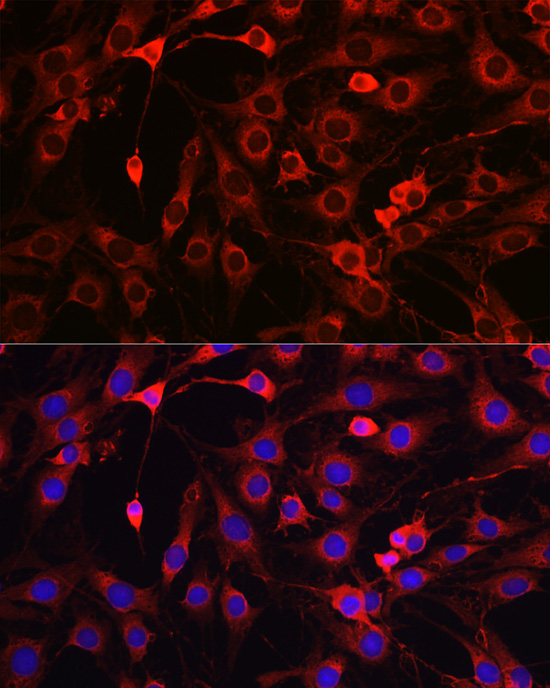 Anti-HMGCR Antibody (CAB1633)