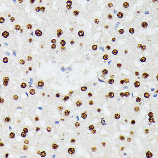 Anti-HNRNPD Antibody (CAB15679)