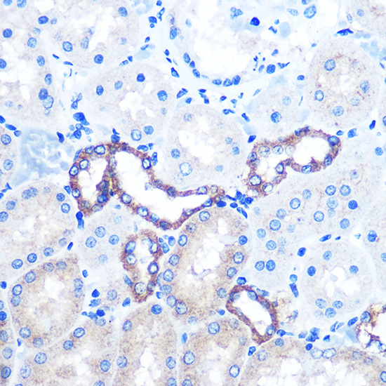 Anti-PKM Antibody (CAB16700)