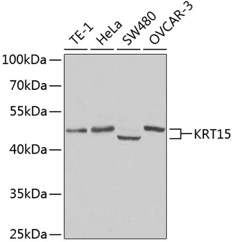 Anti-KRT15 Antibody (CAB2660)