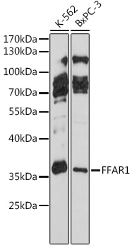 Anti-FFAR1 Antibody (CAB16379)