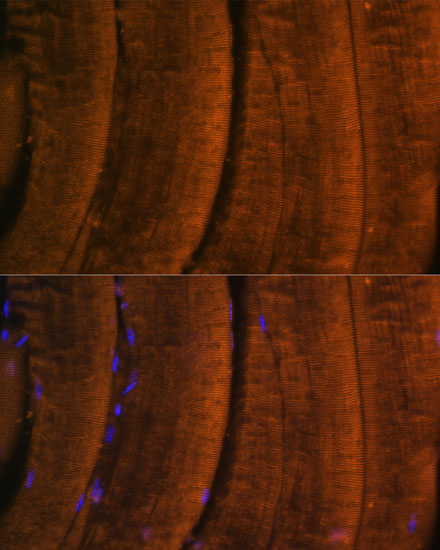 Anti-MYH2 Antibody (CAB15292)