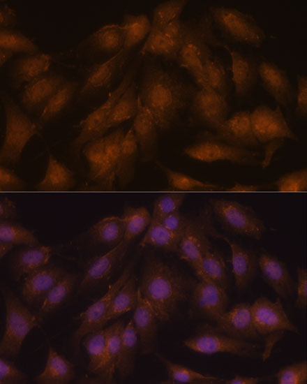 Anti-CDKN2A / p16INK4a Antibody (CAB11058)