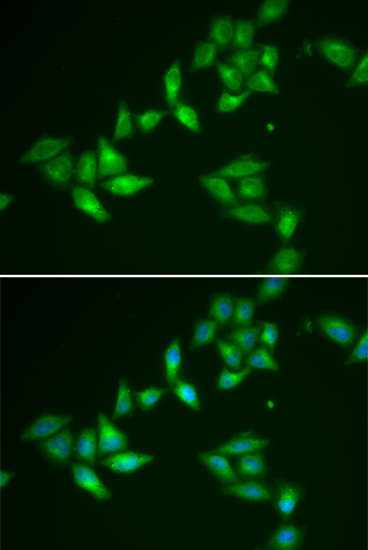 Anti-TXNL1 Antibody (CAB6322)