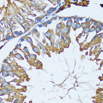 Anti-PRDX3 Antibody (CAB3076)