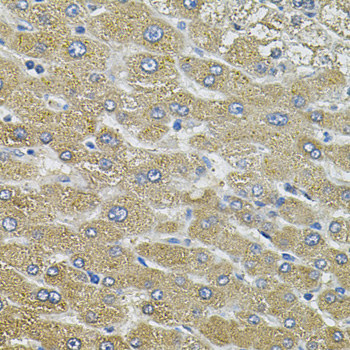 Anti-Aquaporin-5 Polyclonal Antibody (CAB9927)