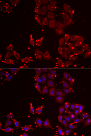 Anti-MSRA Antibody (CAB12464)