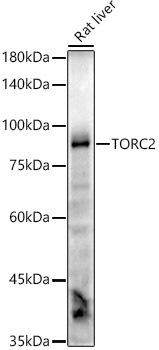 Western blot analysis of extracts of Rat liver, using TORC2 antibody at 1:1000 dilution. Secondary antibody: HRP Goat Anti-Rabbit IgG (H+L) at 1:10000 dilution. Lysates/proteins: 25ug per lane. Blocking buffer: 3% nonfat dry milk in TBST. Detection: ECL Enhanced Kit. Exposure time: 60s.