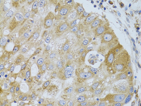 Anti-HDAC8 Antibody [KO Validated] (CAB5829)