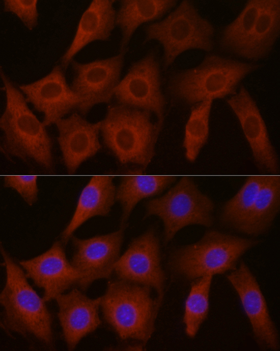 Anti-EIF4E2 Antibody (CAB4305)