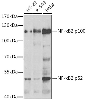 NF-kB2 Rabbit Polyclonal Antibody (CAB5567)