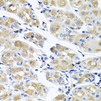 Anti-SPATA4 Antibody (CAB7608)