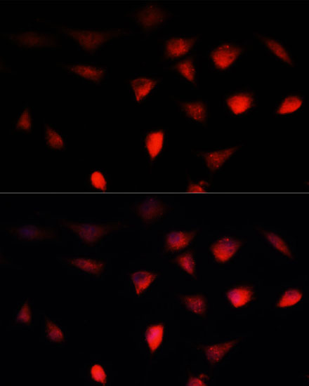 Anti-BRCA1 Antibody (CAB11318)