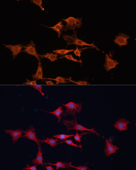 Anti-GSTM3 Antibody (CAB7679)