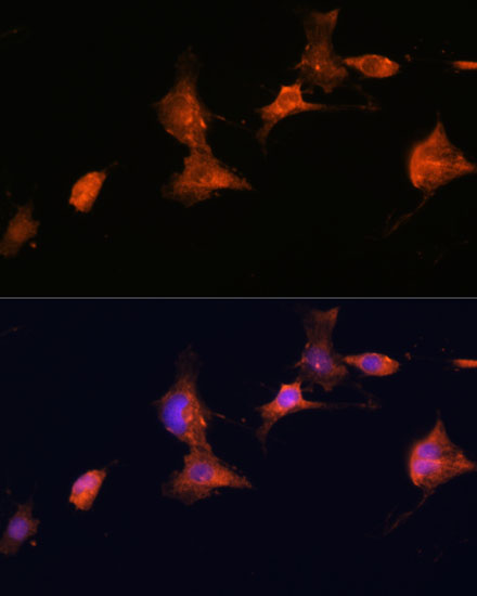 Anti-TSC2 Antibody (CAB16007)