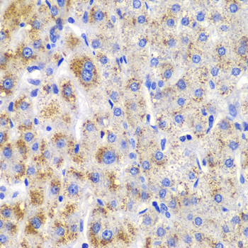 Anti-CBLB Antibody (CAB2014)