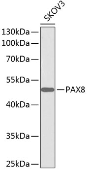 Anti-PAX8 Antibody (CAB1009)