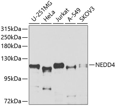 Anti-NEDD4 Antibody (CAB0552)