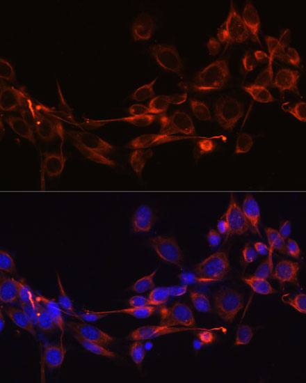 Anti-DKK3 Antibody (CAB2527)