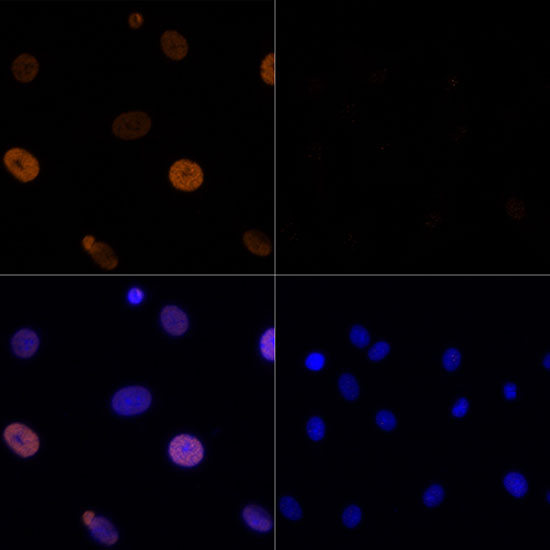 Anti-Acetyl-Histone H3-K56 Antibody (CAB7256)