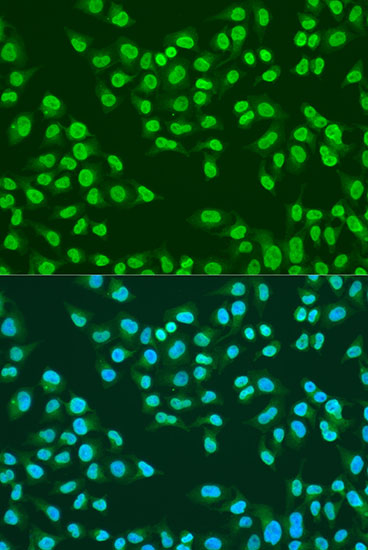 Anti-ATM Antibody (CAB15645)