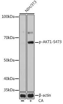 Anti-Phospho-Akt1-S473 mAb Antibody (CABP0637)