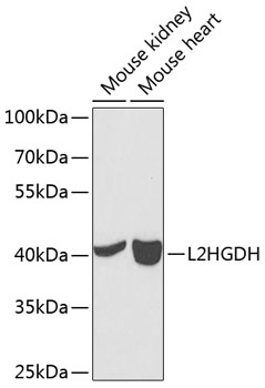 Anti-L2HGDH Polyclonal Antibody (CAB7996)