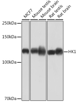 Anti-HK1[KO Validated] Antibody