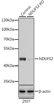 Anti-NDUFS2 Antibody [KO Validated] (CAB12858)