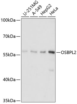 Anti-OSBPL2 Antibody (CAB14199)