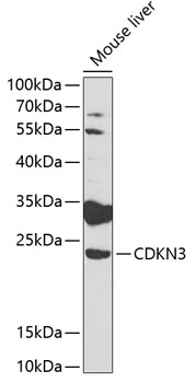 Anti-CDKN3 Antibody (CAB2061)