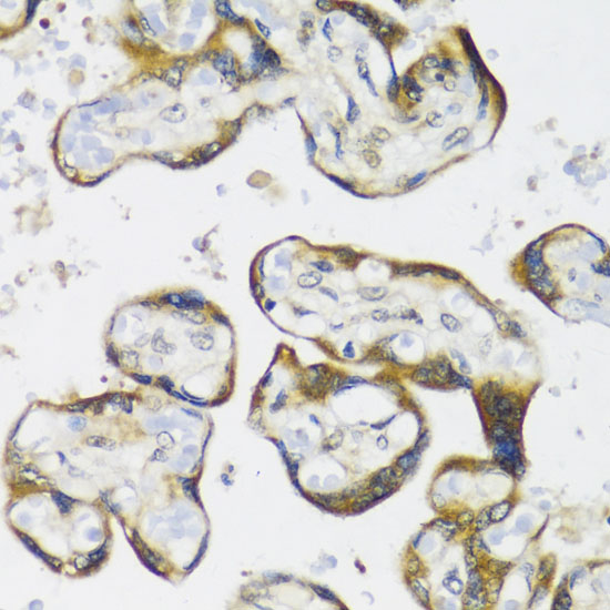 Anti-NMT1 Antibody (CAB16408)