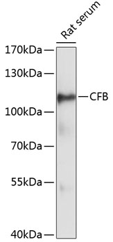 Anti-CFB Antibody (CAB13243)