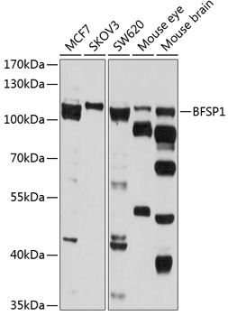 Anti-BFSP1 Antibody (CAB3764)