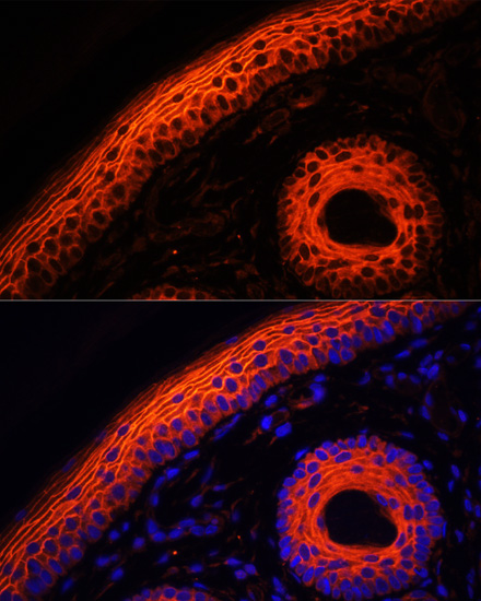 Anti-Desmoglein-1 Polyclonal Antibody (CAB9812)