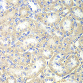 Anti-EPB41 Antibody (CAB12434)