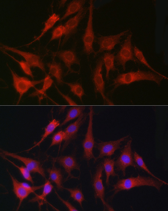 Anti-FSCN1 Antibody [KO Validated] (CAB1904)