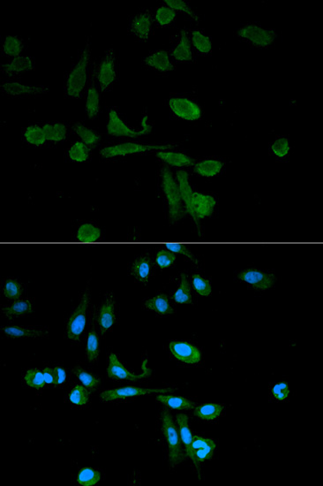 Anti-SIRT7 Antibody (CAB0979)