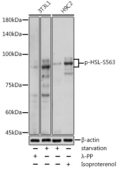 Anti-Phospho-LIPE-S563 pAb (CABP0851)